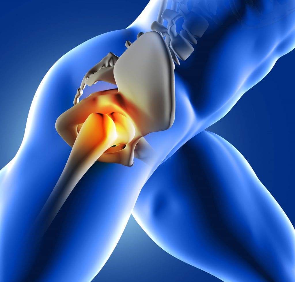 Hip Pain Management