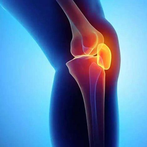 A skeleton of a knee with red and yellow highlighted.