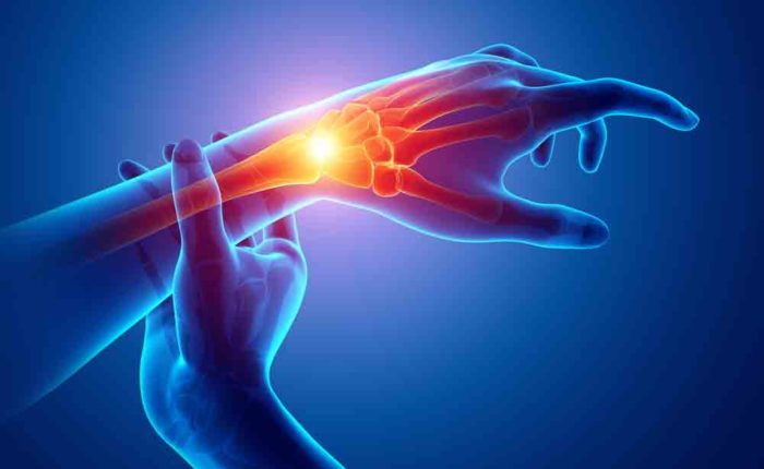 Wrist Pain Causes and Treatment Options