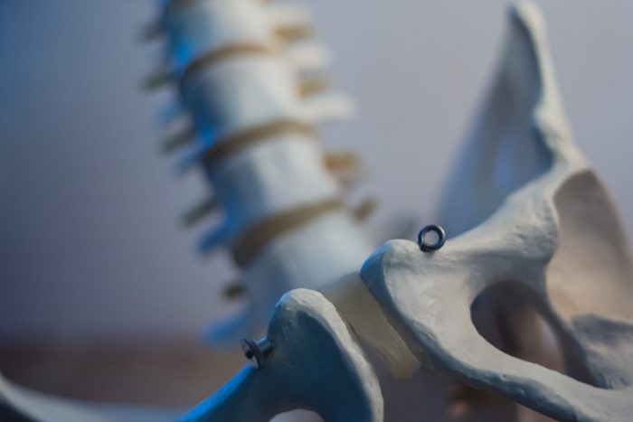 A skeleton of a spine with a metal ring.