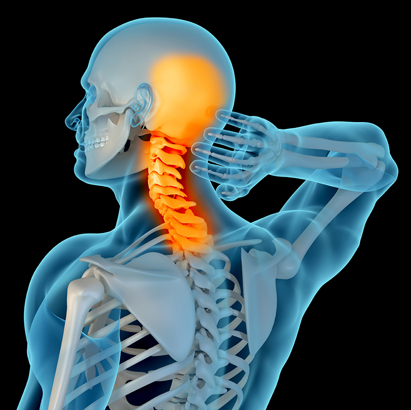 A skeleton with pain in the neck.