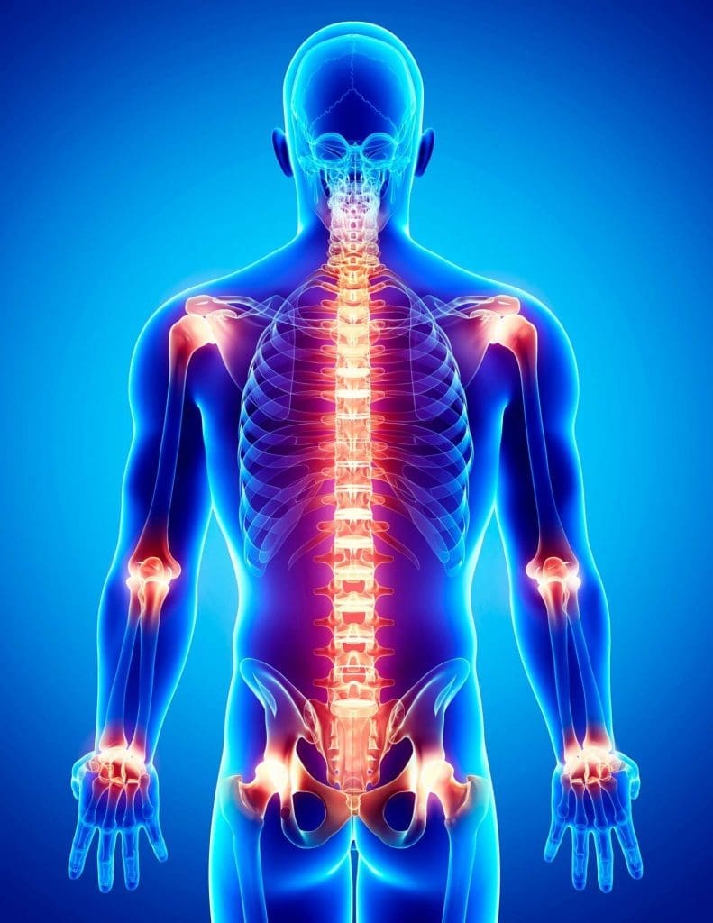 A man with pain in his spine.