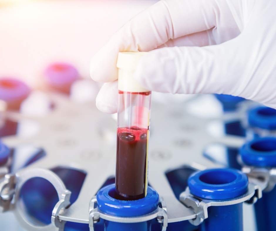 A person is holding a tube of blood in a laboratory.